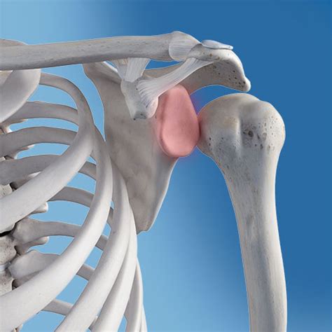 Shoulder Dislocation Diagram