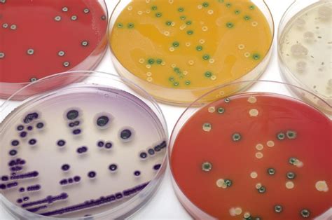 What is Anaerobic Bacteria? (with pictures)