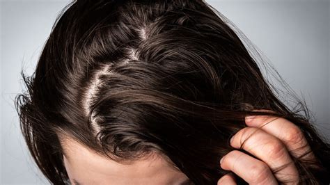 Why Does My Hair Get Greasy So Fast? Our Guide To Greasy Hair