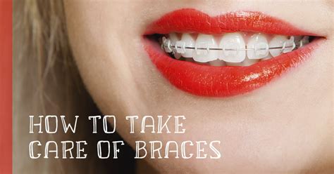 How To Care For Teeth With Braces: Tips for New Braces Wearers - Zuroff ...