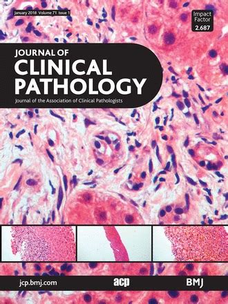 Journal of clinical pathology Impact Factor, Indexing, Acceptance rate ...