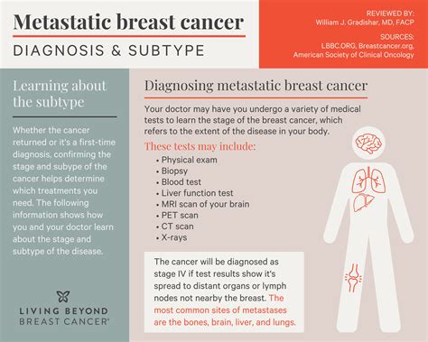 Living with Metastatic Breast Cancer | LBBC