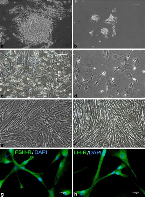 Representative figures of human granulosa cells (GCs) grown in 2% FCS... | Download Scientific ...