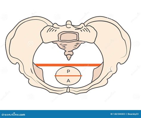 Gynecoid Pelvis Shape With Round / Circular Shape Vector Illustration | CartoonDealer.com #146183996