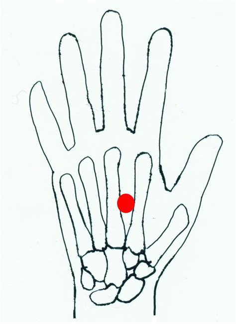 lao gong - acupuncture point picture | Qi gong, Medecine chinoise, Gongs