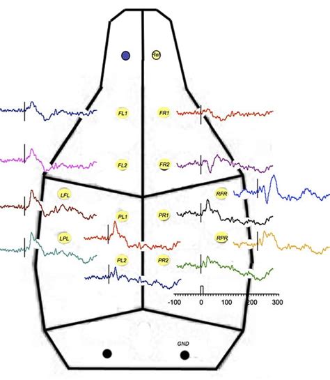 Cortical Sensory Evoked Potentials | Melior Discovery