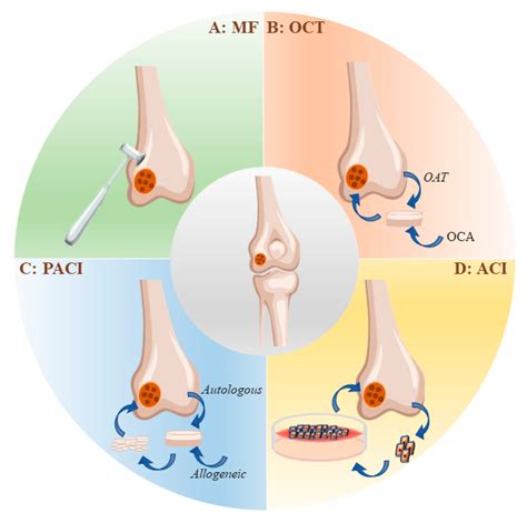 IJMS | Free Full-Text | Effects of Electrical Stimulation on Articular Cartilage Regeneration ...