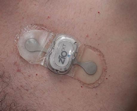 Cardiac Event Monitor - Zio Patch - Loop Monitor, Woodholme ...