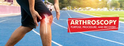 Arthroscopy Surgery - Purpose, Procedure & Recovery