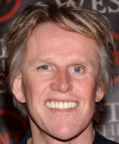 Gary Busey Plastic Surgery Before and After Facelift and Eyelid Surgery | Gossip Plastic Surgery ...