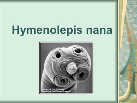 Hymenolepis nana