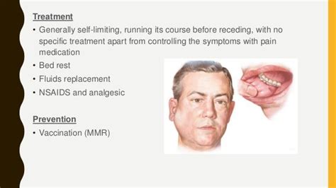 Bilateral Parotid Gland Swelling