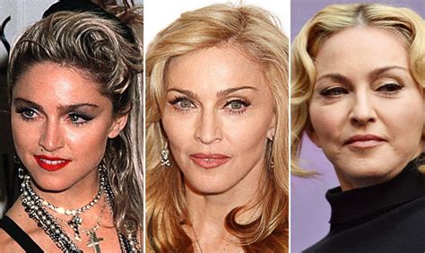 Madonna - what plastic surgeries did she had?