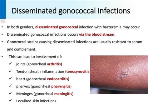 Disseminated Gonococcal Infection