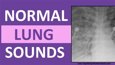 Lung Sounds (Normal) Bronchial Bronchovesicular Vesicular | Breath ...