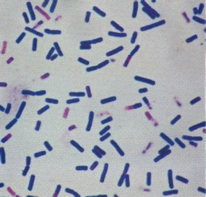 Size, Shape, Arrangement of Bacteria • Microbe Online