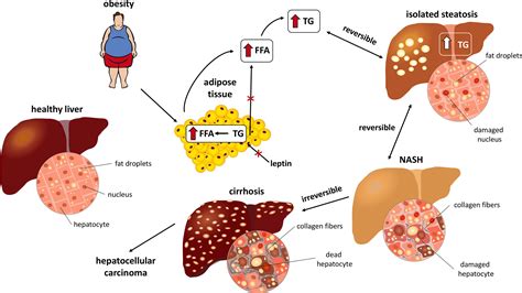 NAFLD/NASH模型 - 格林泰科-新药临床前研究服务平台