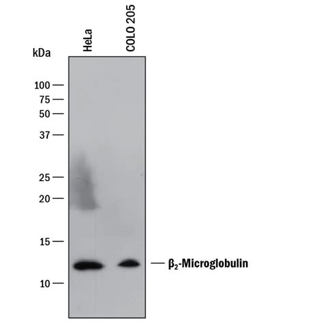 Human beta 2-Microglobulin Antibody MAB8248: R&D Systems