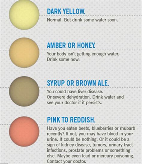 Here’s What The Color Of Your Urine Says About Your Health Brown Ale, Liver Disease, Dark Yellow ...