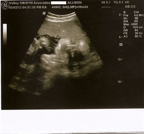 A Little Blueberry: 30 Weeks, Cakes & An Ultrasound!