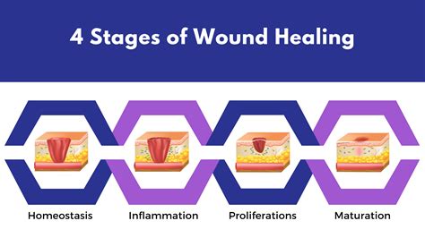 Wound Healing Diagram