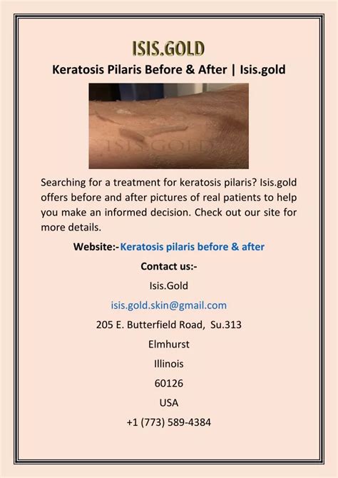 PPT - Keratosis Pilaris Before & After | Isis.gold PowerPoint Presentation - ID:11838046