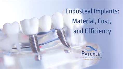 Endosteal Implants: Material, Cost, and Efficiency