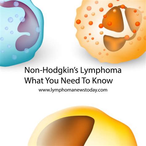 All You Need To Know About Non-Hodgkin’s Lymphoma