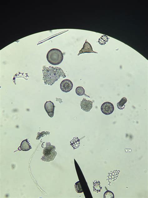 Radiolarians under the microscope. Taken in my Invertebrate Zoology ...