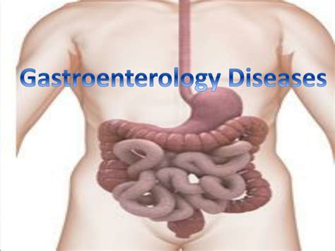 PPT - Gastroenterology Diseases PowerPoint Presentation, free download - ID:1300035