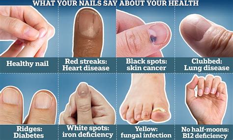 What your NAILS say about your health, according to an expert | Daily ...