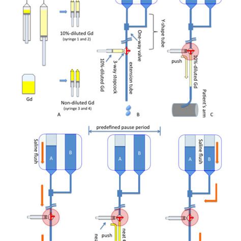 Preparation of the dual-bolus injection scheme for injectors with no ...