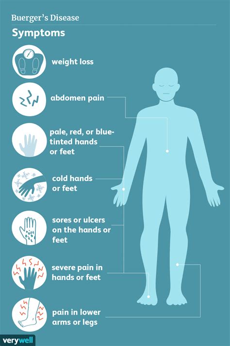 Buerger’s Disease: Symptoms, Causes, and Treatment