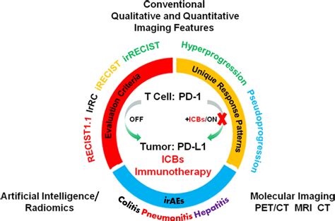 Imaging-based Biomarkers for Predicting and Evaluating Cancer Immunotherapy Response | Radiology ...