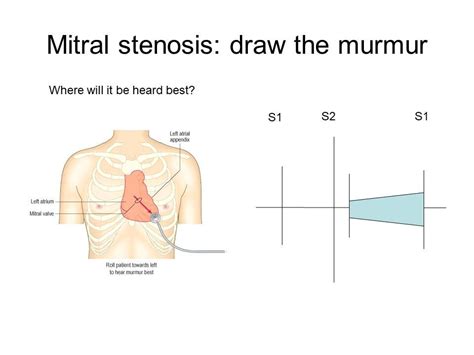 Heart Murmurs — Take Aurally