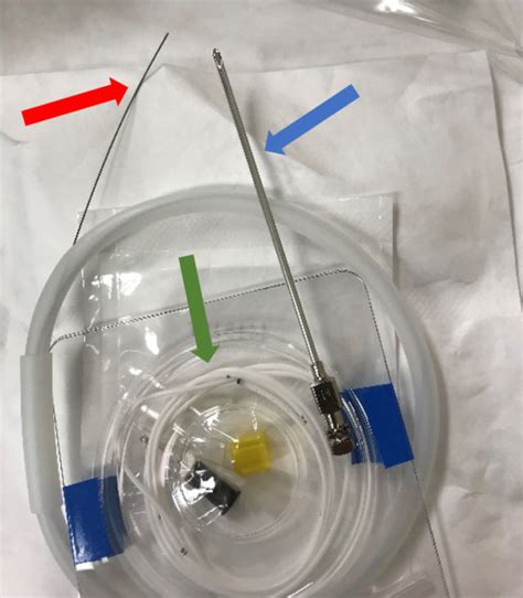 Inability to retract guidewire from catheter during lumbar CSF drain ...