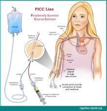 Drawing Blood From Picc Line