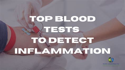 Ultimate Guide: Decoding Inflammatory Markers for Health