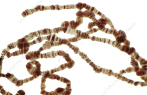 Fruit Fly Chromosomes - Stock Image - C009/3419 - Science Photo Library