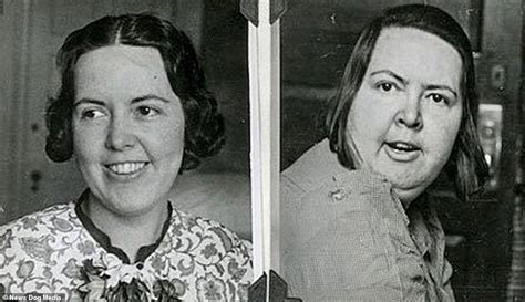 Horror of the lobotomy is revealed in before-and-after images | Daily ...