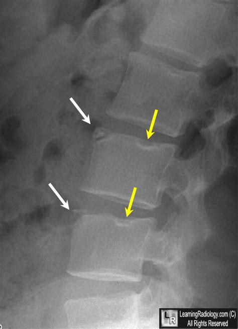 LearningRadiology