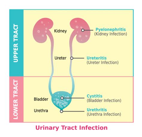 Lower Urinary Tract Symptoms: Reduced Risk by Drinking