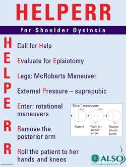 HELPERR- for shoulder dystocia | Midwifery, Midwifery student, Nurse