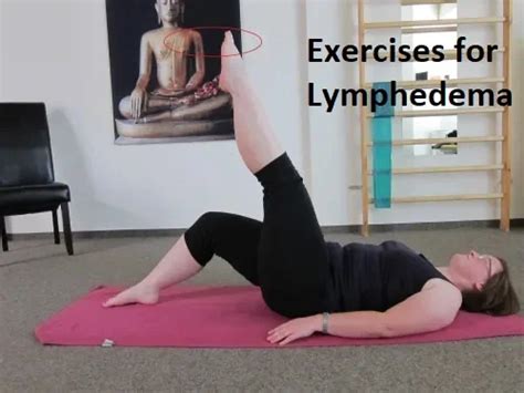 Best Exercises for Lymphedema - Mobile Physio