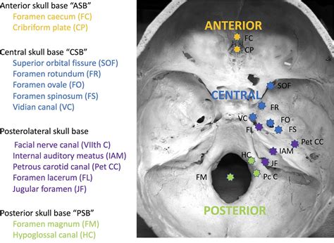 Skull base imaging, anatomy, pathology and protocols | Practical Neurology