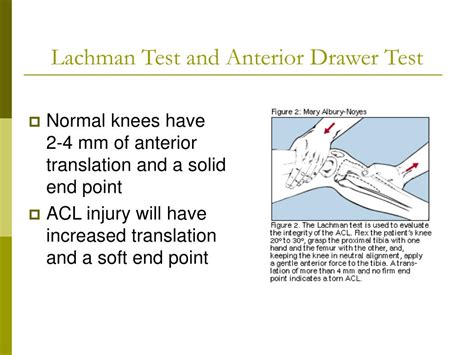 PPT - Knee Injuries PowerPoint Presentation - ID:360300