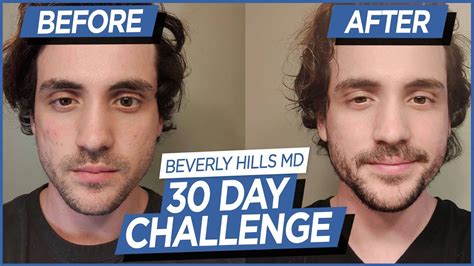 30 Day Skin Care Challenge for Men (Before/After) - YouTube