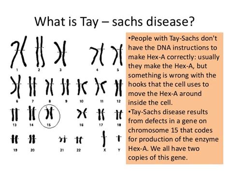 Tay – sachs disease