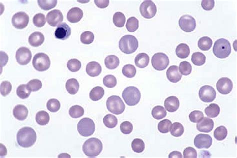 Image: Canine blood smear, markedly regenerative anemia - MSD Veterinary Manual