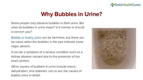 Pictures Of Bubbles In Urine - Go-images Web